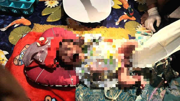 Polisi Buru Pelaku Pembuangan Bayi di Lombok Tengah